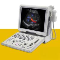 Tragbares Ultraschallgerät Z5 Mindray – Konvexsonde 3,5 MHz inklusive - DICOM